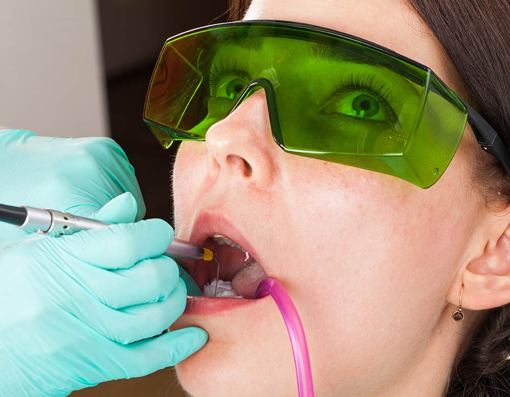 Lasernehandlung beim Zahnarzt